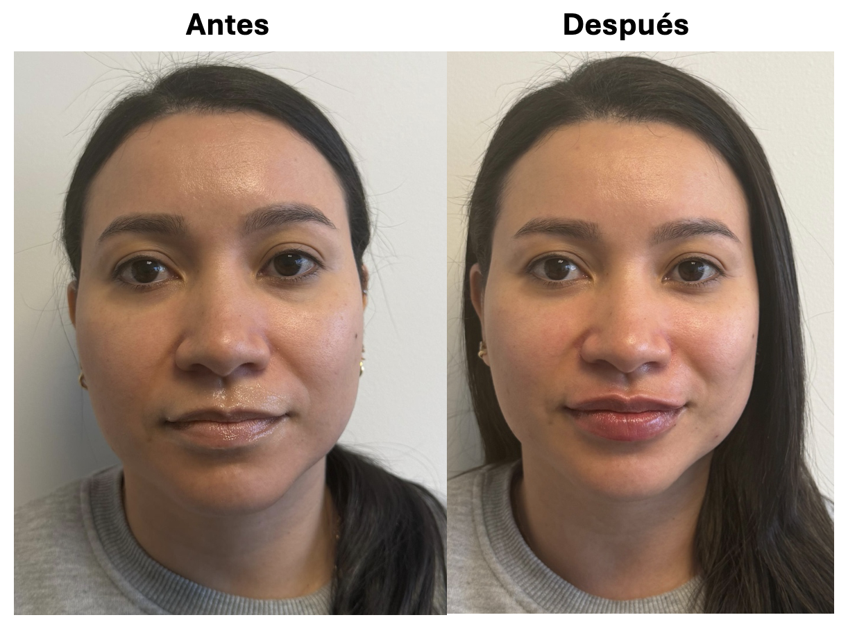 Antes y después del tratamiento