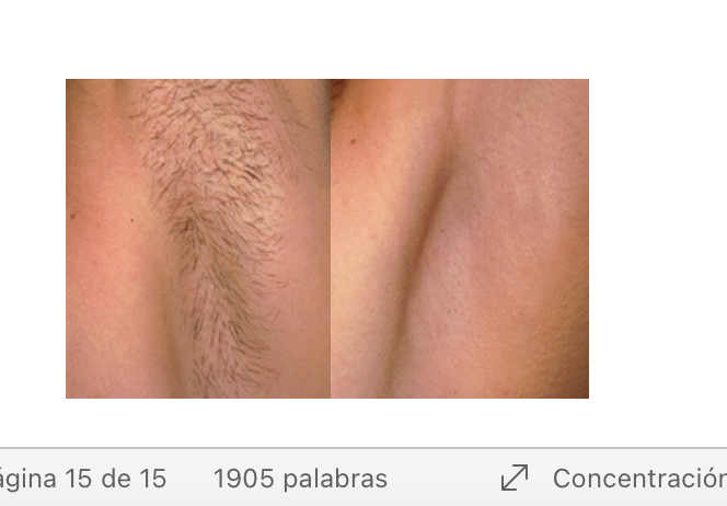 Antes y después del tratamiento