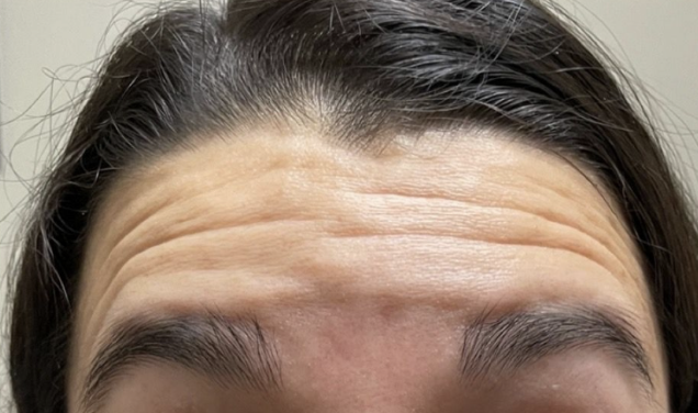 Antes y después del tratamiento